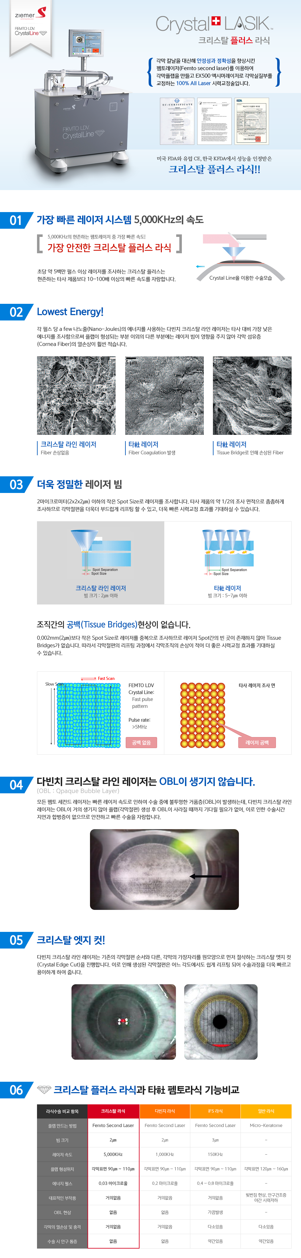 크리스탈 플러스 라식