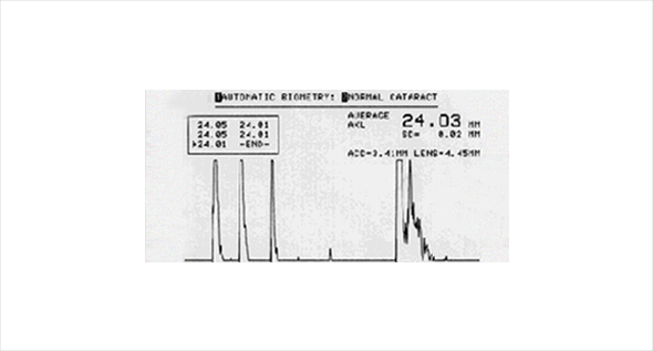 Specular Microscopy