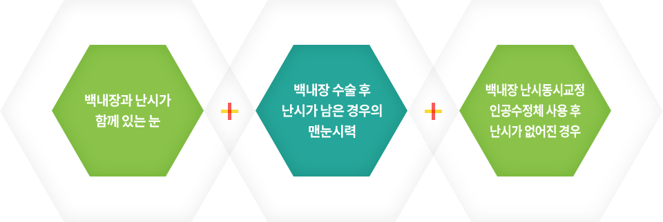 백내장 및 난시동시교정 인공수정체 효과